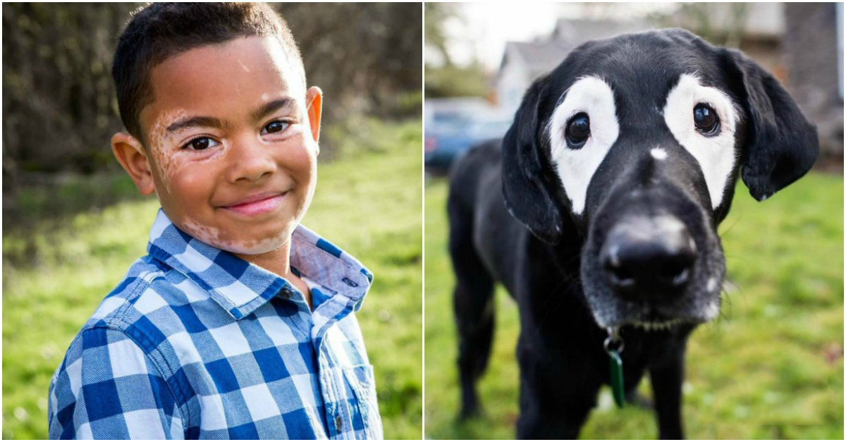 Criança com doença de pele encontra cão com o mesmo problema